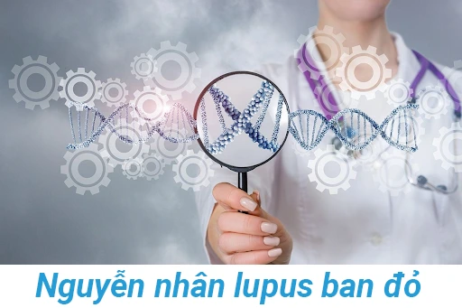 Yeu-to-di-truyen---Nguyen-nhan-lupus-ban-do.webp